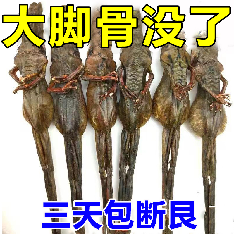 (501% straight) large footed bone toe overlap special paste with hallux valgus deity Thumb Valgus Correction Special WZ-Taobao