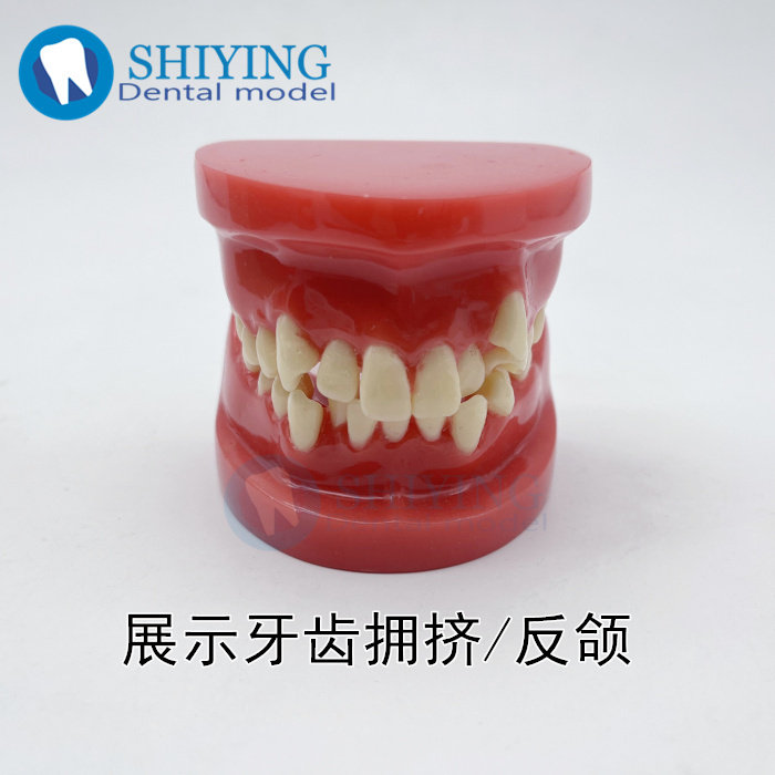 齿科口腔红色正畸矫正模型 牙医练习粘托槽正畸模型矫正教学B4