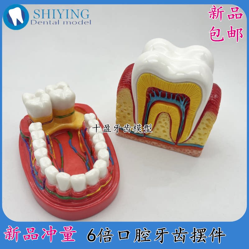 口腔摆件模型 齿科直观教学模型 牙科摆台6倍大模具新品 包邮