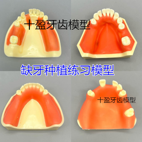 牙科 种植模型 缺失牙修复练习切开翻瓣打孔栽钉 仿真软牙龈 包邮