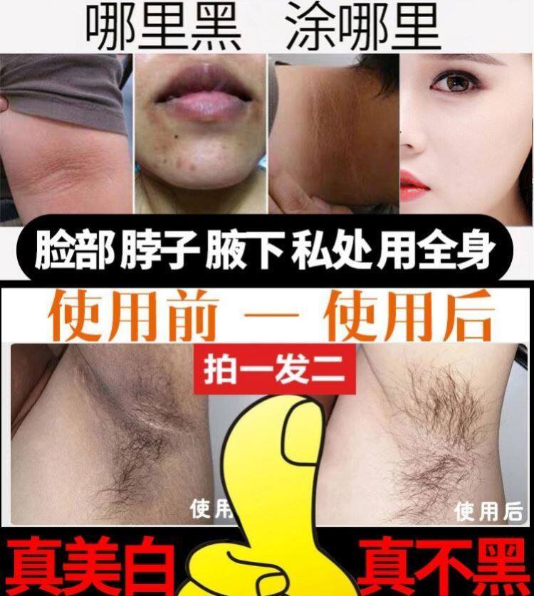Black Leather Neck to Lancet Elbow Melanin Lip Weekly Black Whitening Arm to Black Melanin Armpit Armpits Essence