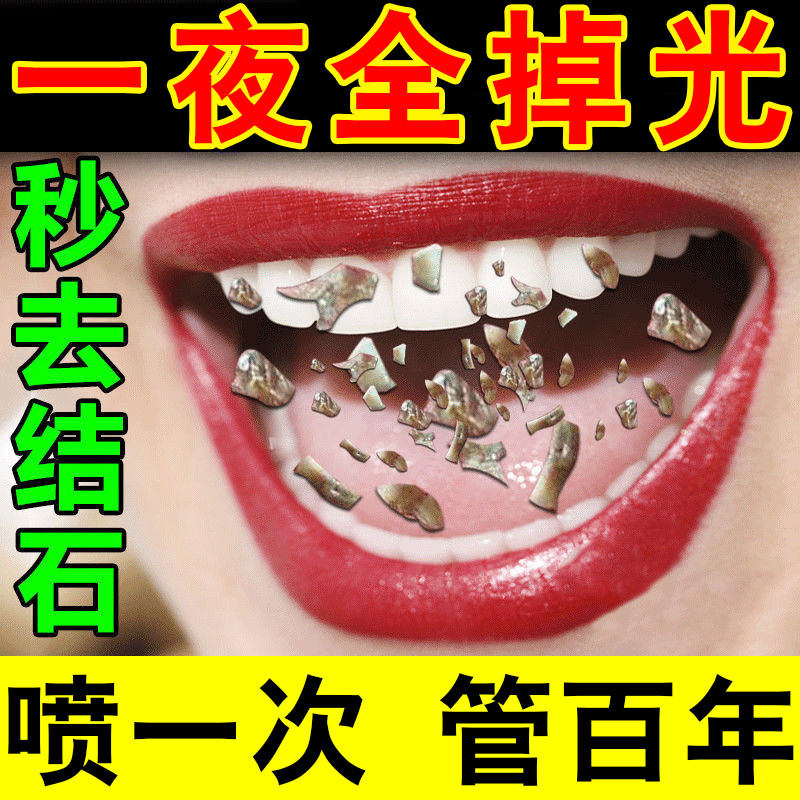 Dental calculus dissolving tartar fast-acting spray tooth cleaning tool tooth yellow tartar black stain remover whitewash artifact