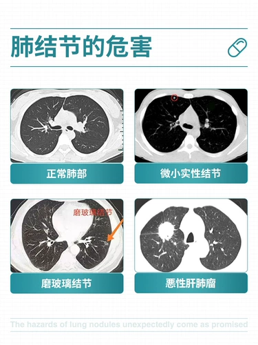 [4 бутылки с особыми преимуществами] Пульсные узелки 槲 槲 槲 槲 槲 槲 槲 槲 槲 槲 槲 槲 槲 槲 槲 槲 槲 槲 槲 槲 槲 槲 槲 槲 槲 槲 槲 槲 槲 槲 槲 槲 槲 槲 槲 槲 槲 槲 槲 槲 槲 槲 槲 槲 槲 槲 槲 槲 槲 槲 槲 槲 槲 槲 槲 槲 槲 槲 槲 槲 槲 槲 槲