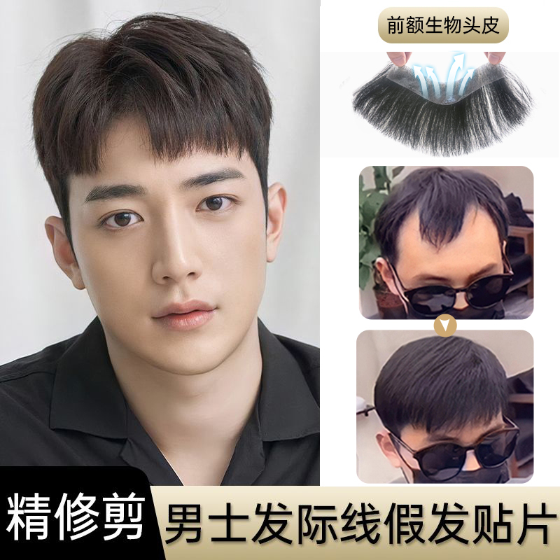 Hairline wig stickers men's forehead hairline fake bangs piece invisible seamless real hair M-type forehead replacement piece