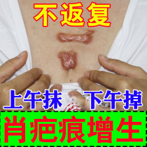 Scar repair and scar removal cream imported scar burn hyperplasia old burn scar concave and convex dilute double eyelid scar