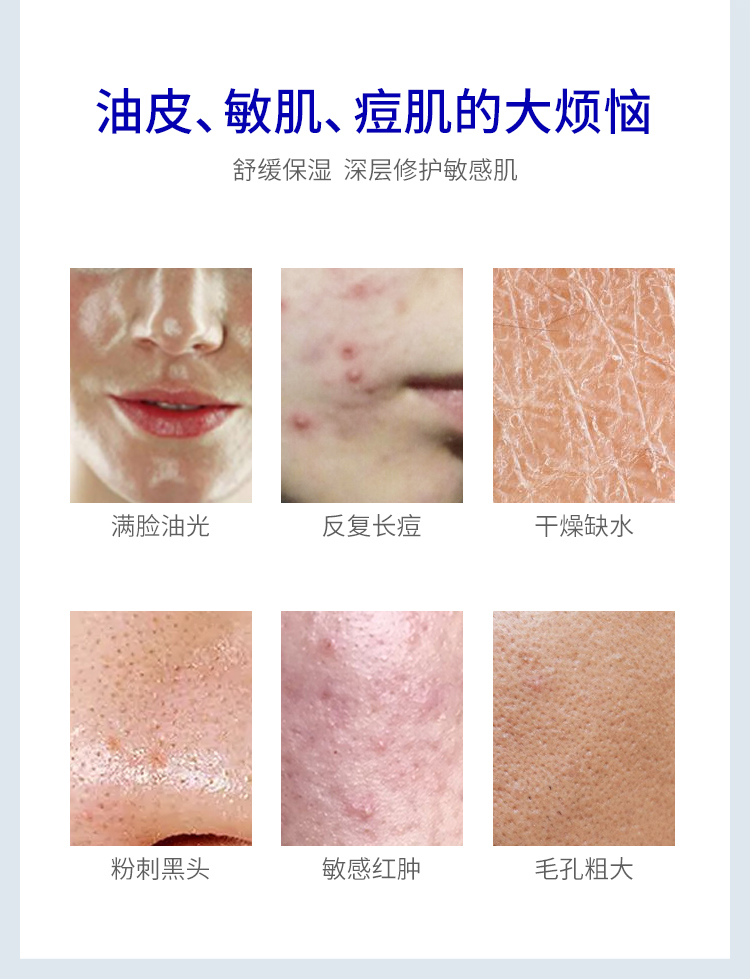 豆妃 喷式舒缓精华液 30ml 补水保湿 舒缓敏感肌 图3