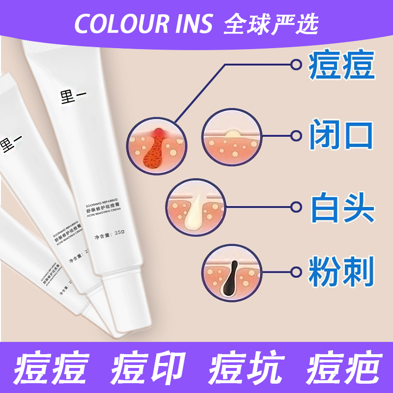 Anti-acne cream inflammation to remove acne red swelling acne marks acne pit repair closed acne acne scar lotion ointment artifact male