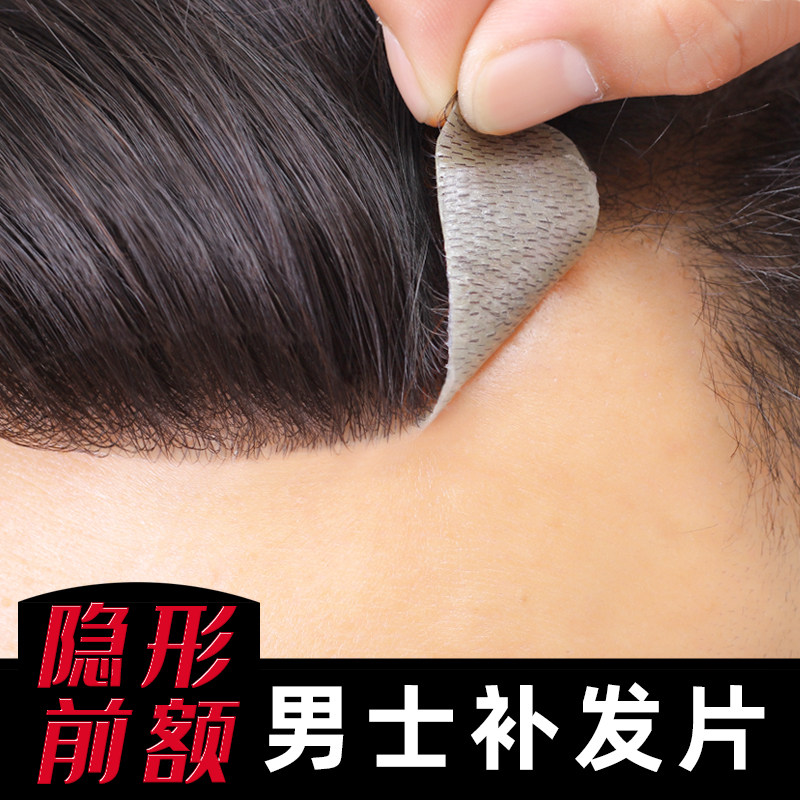 Hairline wig male M-type prefront invisible bioscalp patch real hair browsing head replenishment film