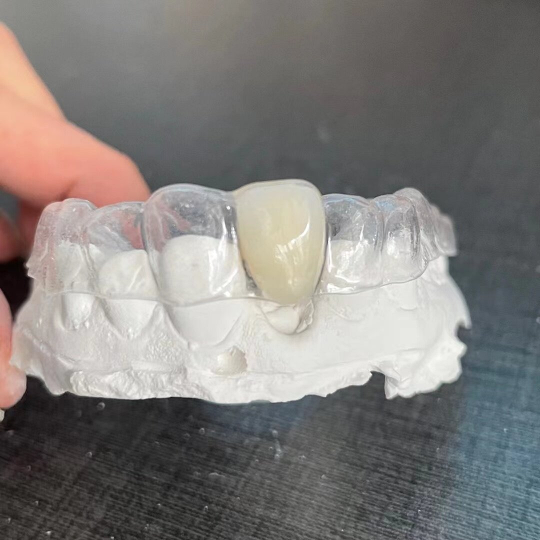 Planting Teeth Temporary Transparent Invisible Braces Set For Toothless Toothless Door Tooth Missing Covering Braces Customization