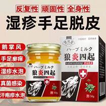 (Preferred) Eczema peeling skin on hands and feet fungal infection sweat herpes small blisters goose palms rotten feet athletes foot itchy relief