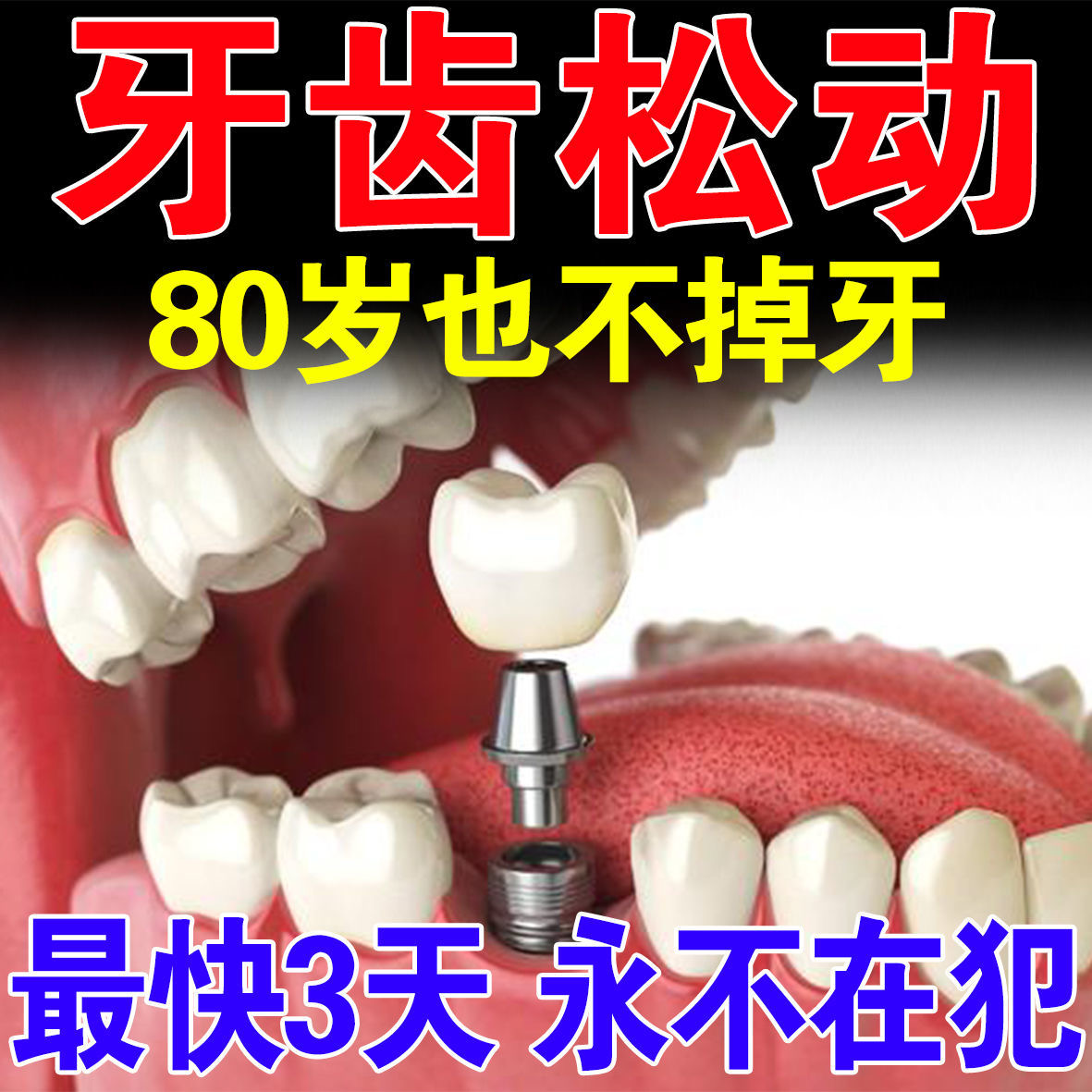 Teeth shaking, fixed teeth, periodontitis, gum swelling, pain, bleeding, atrophy, repair and regeneration of gaps between teeth, wide filling medicine artifact