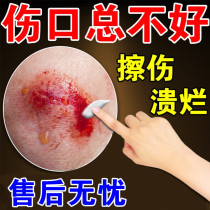 (Imported from Japan) Wound-healing and muscle-growing medicine for rotten feet old rotten legs bedsores and myogenic ointment for wounds and myogenic powder