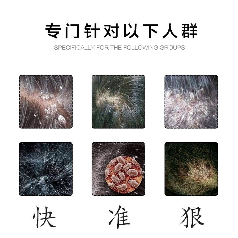 头皮屑终结者来了！贝漩发舒爽洗发水为何能“真香”到让人离不开？_洗发水_淘宝美妆网