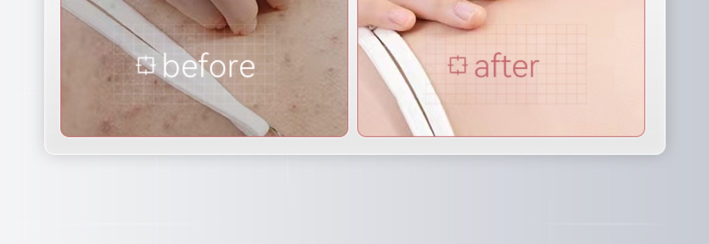 【中國直郵】 VHE 祛痘美白沐浴露 全身煥發保濕水潤持久留香乳液洗護男女 400g/瓶