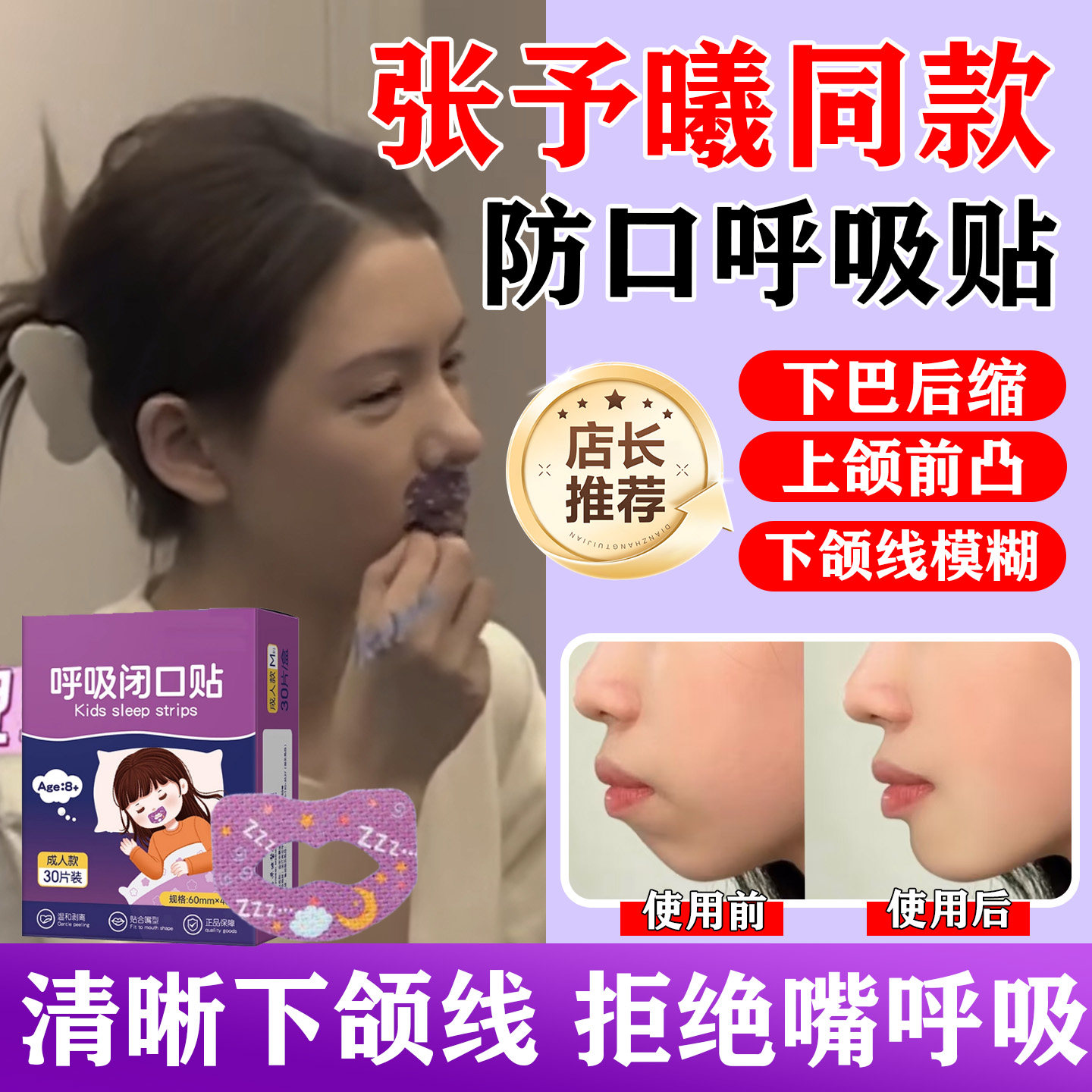 口呼吸矫正贴张予曦同款闭嘴神器成人儿童张嘴睡觉闭口贴防凸嘴ag