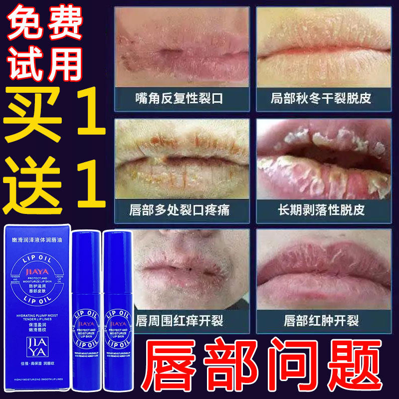 (buy 1 to 1) Zhikya Lip Shizheng Lip Peeling Dry Crack Lip Lip Lip Lip Lip Lipstick
