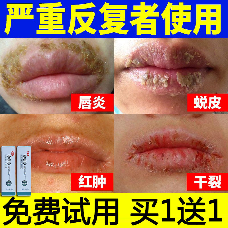 Lip Balm Lip Yan Materia Medica Dew Yunnan Balm Rain No. 2 1 Baiyujitang Lingcao Kangling Research Kang Mu An Ning ͌