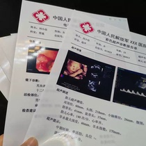 Medical film gastroscopy B-ultrasound color ultrasound inspection report printing paper A4 inkjet laser color 16K porcelain white glue