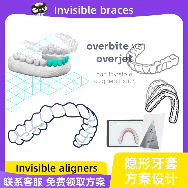 歯列矯正用デザイン、目に見えないブレース、ボックスリテーナー、歯ぎしり防止、透明ブレース、歯の隙間を矯正