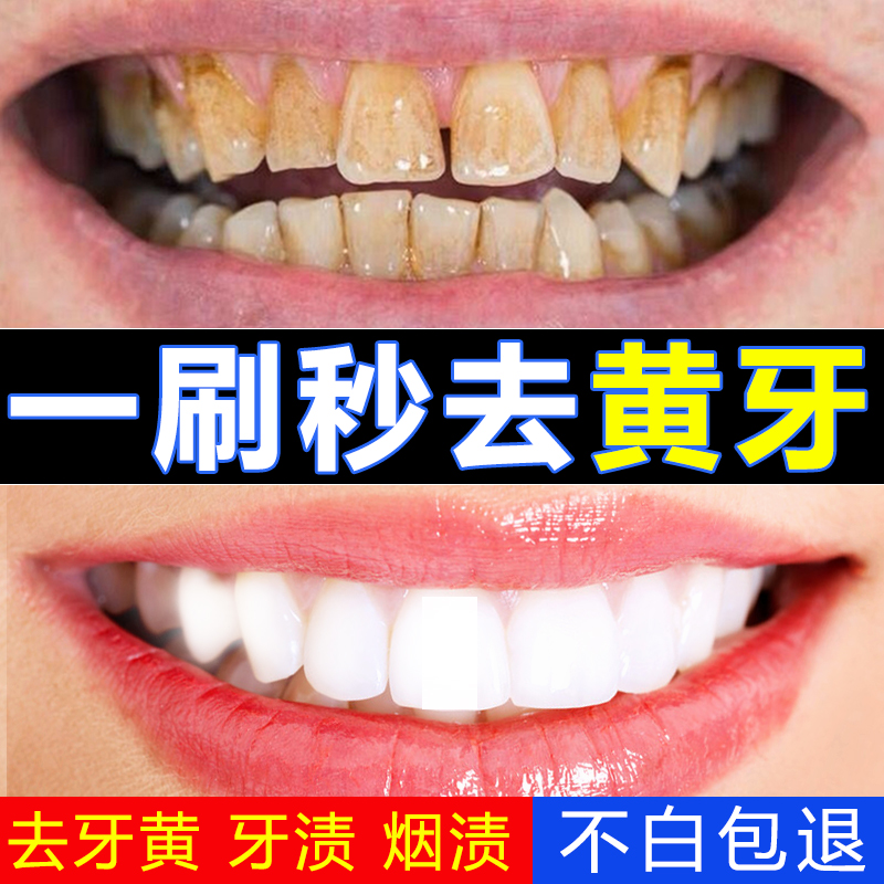 Go to Yellow toothpaste Quick-impact whitening teeth Go to dental calculus Go to smoke stains desensibilized dental bacteria dirt halibut universal