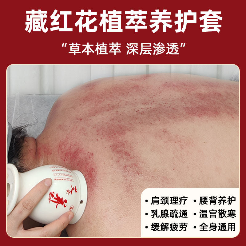 身体套盒美容院专用藏红艾灸发热草本精油药刮痧罐按摩推背通经络值得买吗?_单方精油_淘宝美妆网