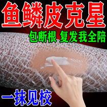 Fish scale skin cream to fish scale snake skin disease dry peeling chicken skin pimple hair follicle keratosis moisturizing body milk