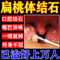 Tonsil stone removal tool throat foreign body feeling bad breath tonsil inflammation pain swollen crypt rinser