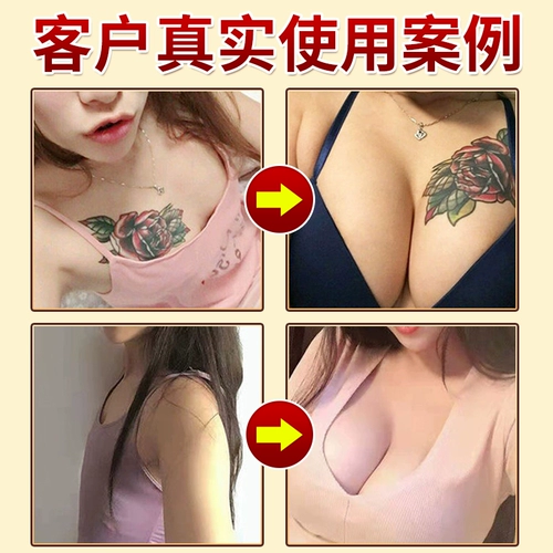 Увеличивающий быстрый послеродовой поддерживающий крем для здоровья груди