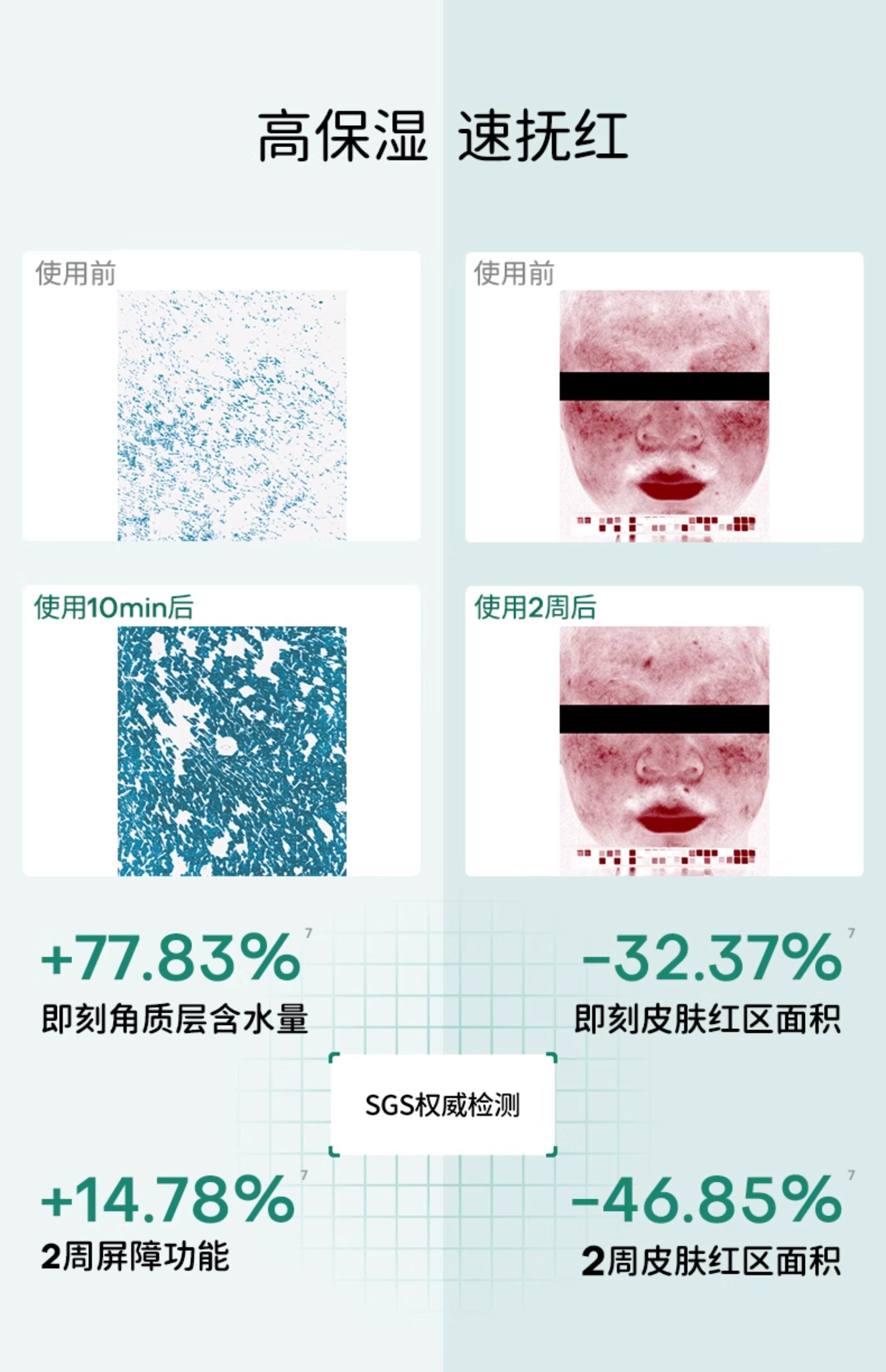 【中国直邮】 达肤妍 B5面膜 补水修护保湿舒缓敏感 10片/盒