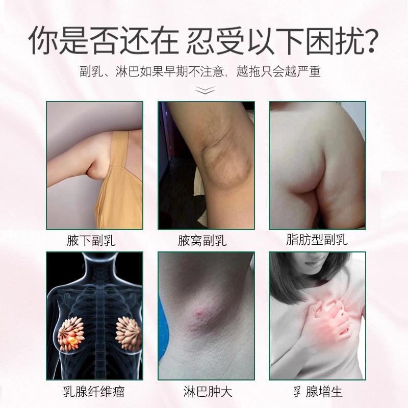 (Severe auxiliary breast elimination paste) plaster to remove auxiliary breast artifact axillary lymph nodes to clear the breast enlargement