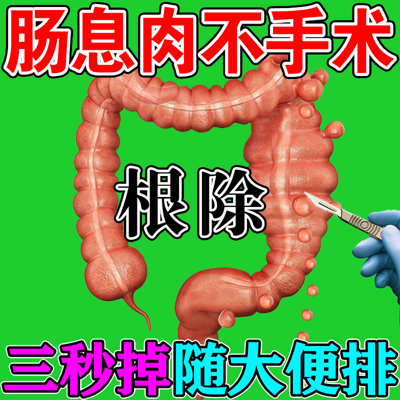 Intestinal polyps (three days cured) for the treatment of intestinal polyps Gastroenteritis Gastritis Diarrhea tummy flatularum Gastroenterostica