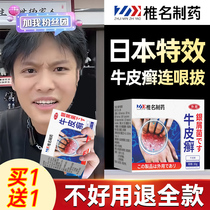 Psoriasis Cow Leather Moss Special Ointment and Ointment Germicidal Treatment of Ointment Relieves the Curative Effects of Curative Effect