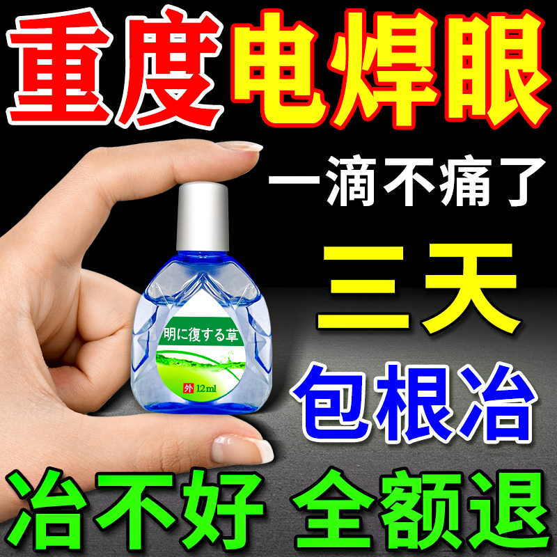 Electric welding eye drops to cure eyes red blood silk for fear of light heteromateria fever welding king electric welding eye special eye medicine eye drops-Taobao