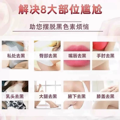 Черные ягодицы на внутренней стороне бедра, чтобы перейти к черному и сесть на локоть и шею, черная эклипсиия, черная эпителиальная болезнь Удалите осадки меланина