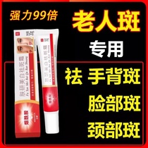 Spot removal cream specializes in removing age spots special face removal cream for hands and back of hands powerful removal