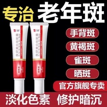 Spot removal cream specializes in removing age spots special face removal ointment for hands and back of hands powerful removal