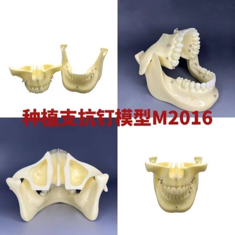 牙科口腔模型 学生练习种植模型 支抗钉练习模型 发泡仿真骨模型