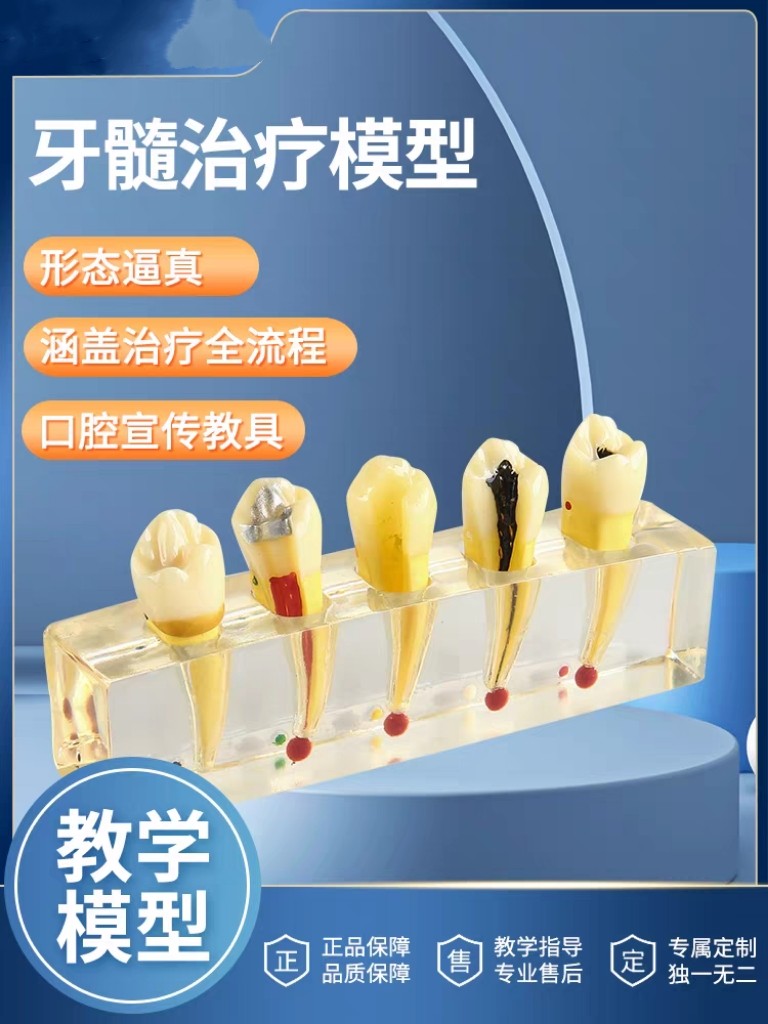 牙科牙髓模型解剖前磨牙龋坏牙冠髓腔充填可拆牙陈列展示练习模型