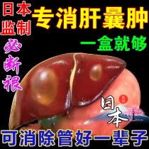 Liver cysts for the treatment of liver cysts The herbal tea hepatocyst treatment removal of the ointment to protect the liver and liver-nourishing liver