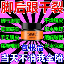 Specially designed to treat cracked feet cracked heels crusty skin repair cream peeling fungal infection sole peeling anti-cracked feet cream
