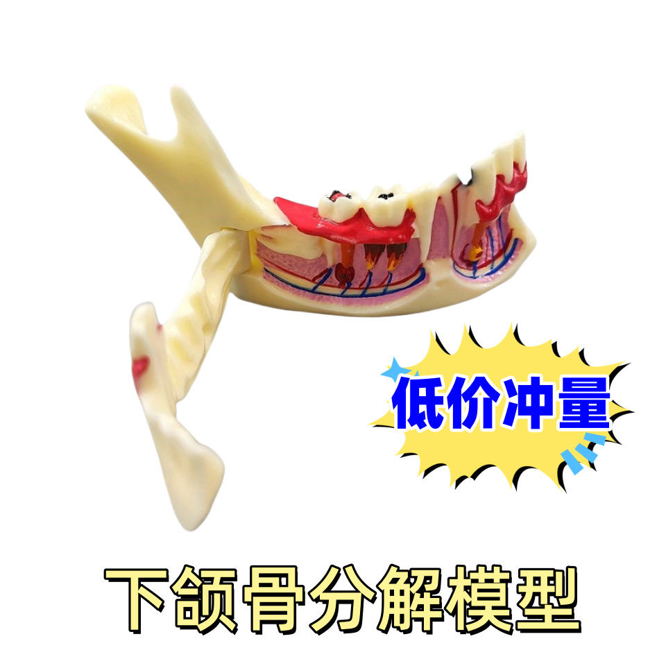 下颌骨分解牙科口腔教学模型下颌骨组织分解模型牙神经牙龈