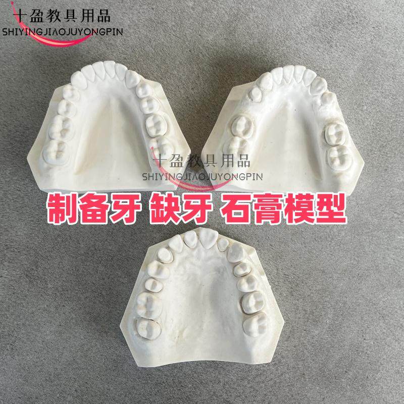 牙科石膏模型 缺失牙石膏模型 标准缺牙制备牙齿口腔教学练习包邮