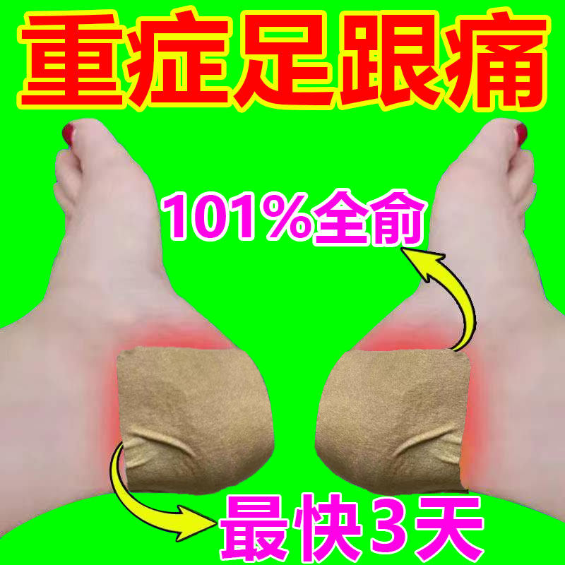 Heel Pain Sticking Heel Pain Medicine Special Sticking Cream Heel Pain Foot Heel Bone Tingle Plantar Fascia Tingling Pain
