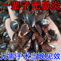 (Rhinitis nemesis) Special medicine for rhinitis seasonal allergic sinusitis nasal congestion and runny nose rhinitis patch