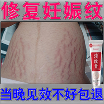 Remove obesity and growth marks eliminate stretch marks after childbirth firm belly inner thighs calves waist and abdomen cream
