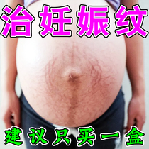 Stretch Marks Elimination Stretch Marks Firming Belly Ointment Special Ointment to Treat Obesity Stretch Marks Growth Stretch Marks Postpartum Protection Artifact