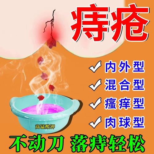 Таблетки перманганата калия для внешних геморрой и медицины для вагинала, гинекология, перманганатное перманганатное перманганатное перманганатное перманганатное перманганатное калиевое калиевая ацета ацета CS