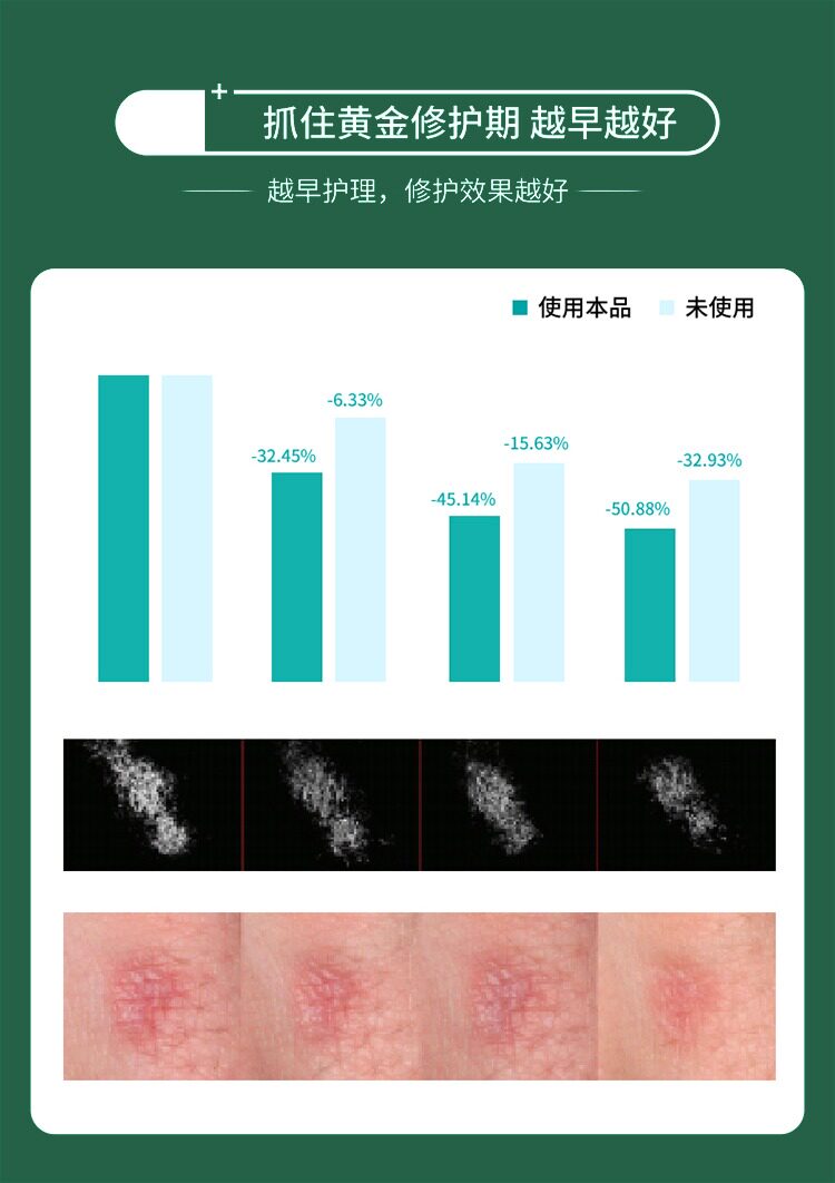 Убрать растяжки массажер 【日本爆款热卖】日系疤痕滚珠修复剖腹产增生凹凸疤痕全身 OTHER