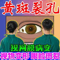 Macular eye (macular degeneration) eye drops relieve vision loss blurred vision deformation dark shadow macular degeneration