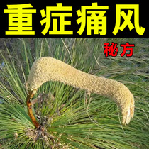 (Shenfang cures gout) New version of gout special drug to reduce uric acid and eliminate crystallized thumb swelling and deformation artifact XX